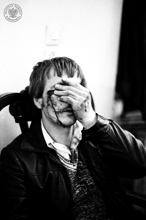 Wprowadzenie stanu wojennego w Gdańsku. Zakrwawiony mężczyzna prawdopodobnie po starciu z funkcjonariuszami Milicji Obywatelskiej. Fot. Stanisław Składanowski